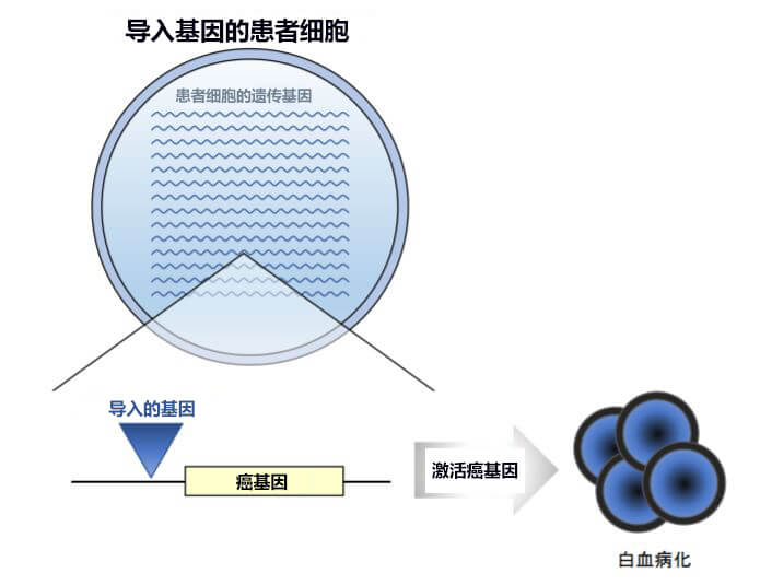 基因改造细胞白血病化机制